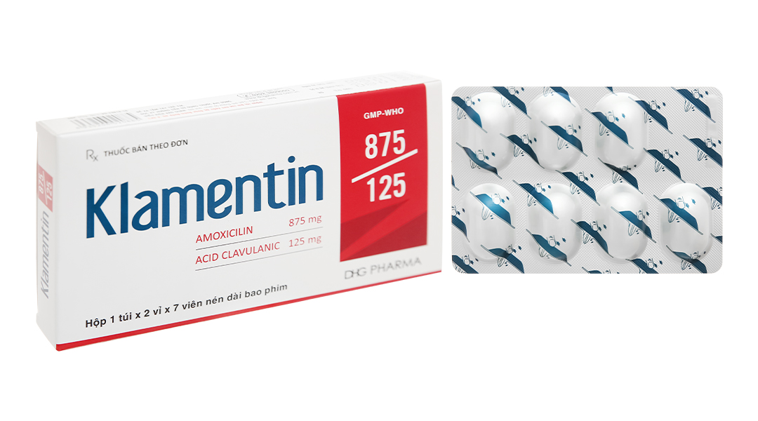 Klamentin 875/125 trị nhiễm khuẩn đường hô hấp trên và dưới